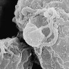 Electron micrograph of human immunodeficiency virus (HIV): a new proposal is testing whether wider use of ARVs can prevent the spread of the virus. Credit:  Cynthia Johnson/CDC
