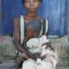 Worried mothers are bringing malnourished children to treatment centres for care, but political instability is limiting the assistance available. Credit:  Tomas de Mul/IRIN