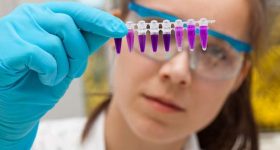Women Have Always Trailed Men in Research Output: How COVID Made the Situation Worse - Vimarsana News