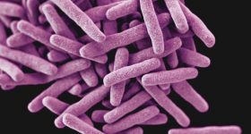 Anti-Microbial Resistance Strategies Need Urgent Attention in Africa - Vimarsana News