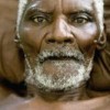 A man lies in his hospital bed in Jacmel, Haiti, one of thousands who have sought medical assistance after the violent Jan. 12 earthquake. Credit: UN Photo/Marco Dormino