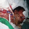 Electricity and fuel shortages in Gaza affect the critically ill, like this man injured in an Israeli air raid. Credit: Mel Frykberg/IPS