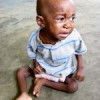 Nearly forty percent of Liberian children under five are malnourished. Credit:  Bonnie Allen/IPS