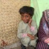 Many children in Pakistan are severely undernourished. Credit: Zofeen Ebrahim