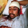 Injured Pakistani migrant worker following an attack in Manama. Credit: Courtesy of Pakistan Embassy to Bahrain