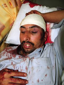 Injured Pakistani migrant worker following an attack in Manama. Credit: Courtesy of Pakistan Embassy to Bahrain