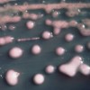 Superbug carbapenem-resistant Klebsiella pneumonia (CRKP) Credit: Public domain