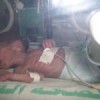 A baby in Shifa hospital in Gaza struggles against illness and lack of medicines and electricity. Credit: Cherrie Heywood