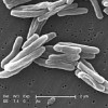 Tuberculosis bacteria multiply quickly in people with weakened immune systems, like children, the elderly and those living with HIV/AIDS. Credit: Janice Carr/CDC