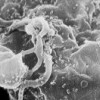 HIV in human cell. Credit: Public domain