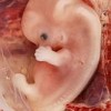 A nine-week-old human embryo Credit: Ed Uthman, MD
