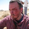 Joel Gullege after being assaulted by Israeli settlers. Credit: Mel Frykberg