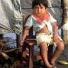 Children under 5 are affected most by environmental problems - Claudio Contreras.