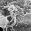 HIV developing in a human cell. - Public domain